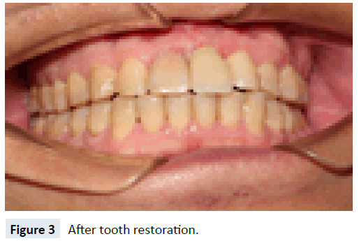 health-medical-economics-tooth-restoration